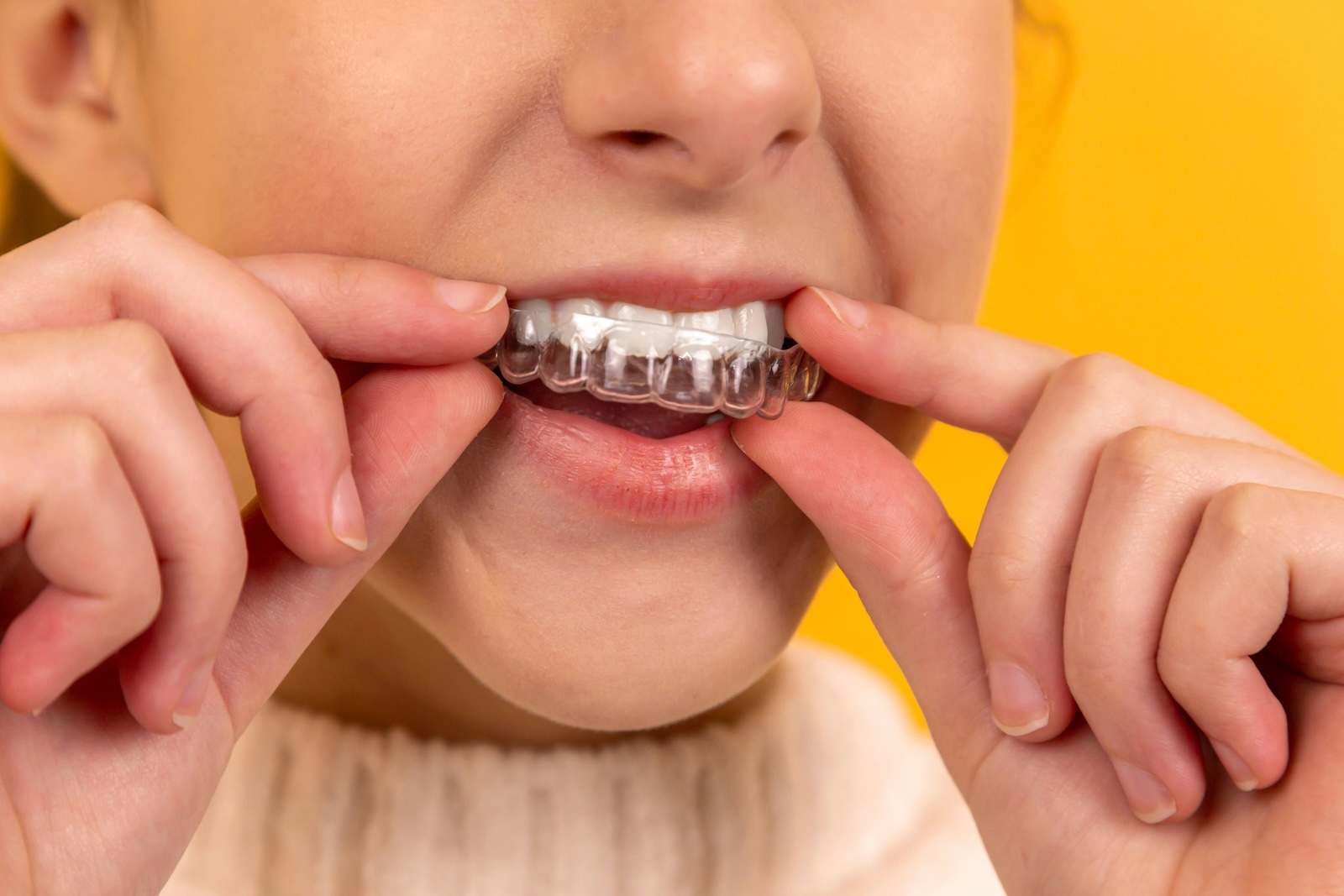A woman smiling while holding her teeth with braces, showcasing her dental treatment related to Invisalign.