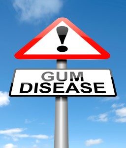 tooth extraction Grand Prairie