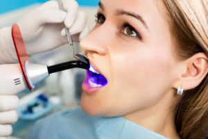 a woman having her teeth bonded by a dentist