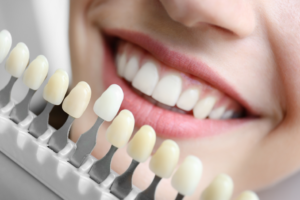 a person having a shade chart held up to their teeth by a dentist