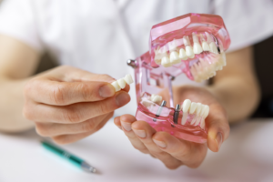hands holding a model of an implant bridge in a mouth