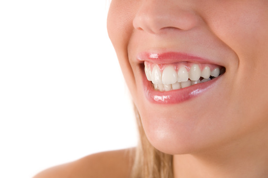 veneers Arlington TX