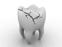 dentist in Grand Prairie